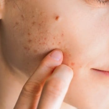 Certificazioni e qualità Farmabe